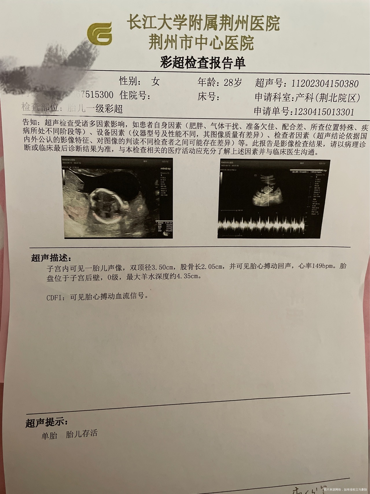 您好医生我是怀孕16周第6天这个最大羊水深度