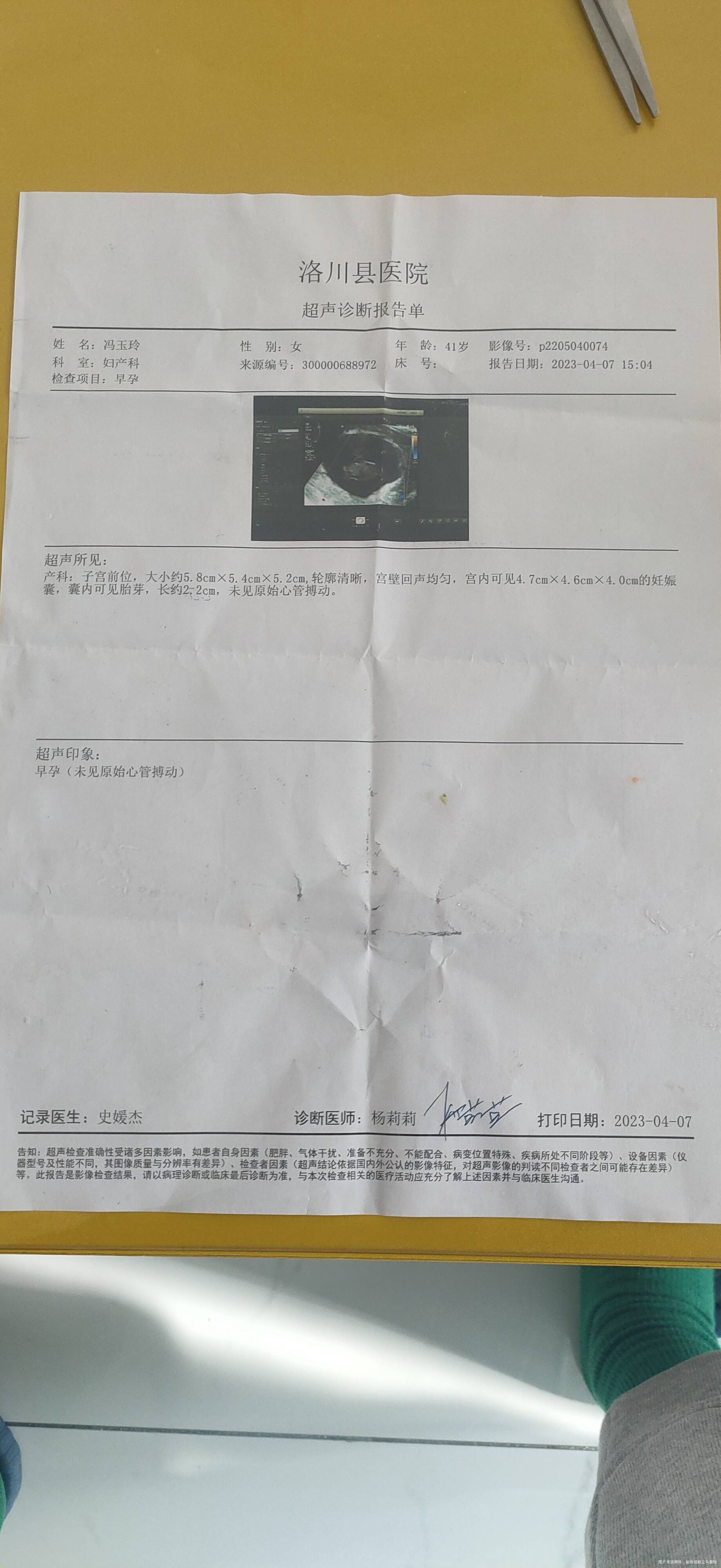 末次126十天前的血值和b超都挺好8小时一片