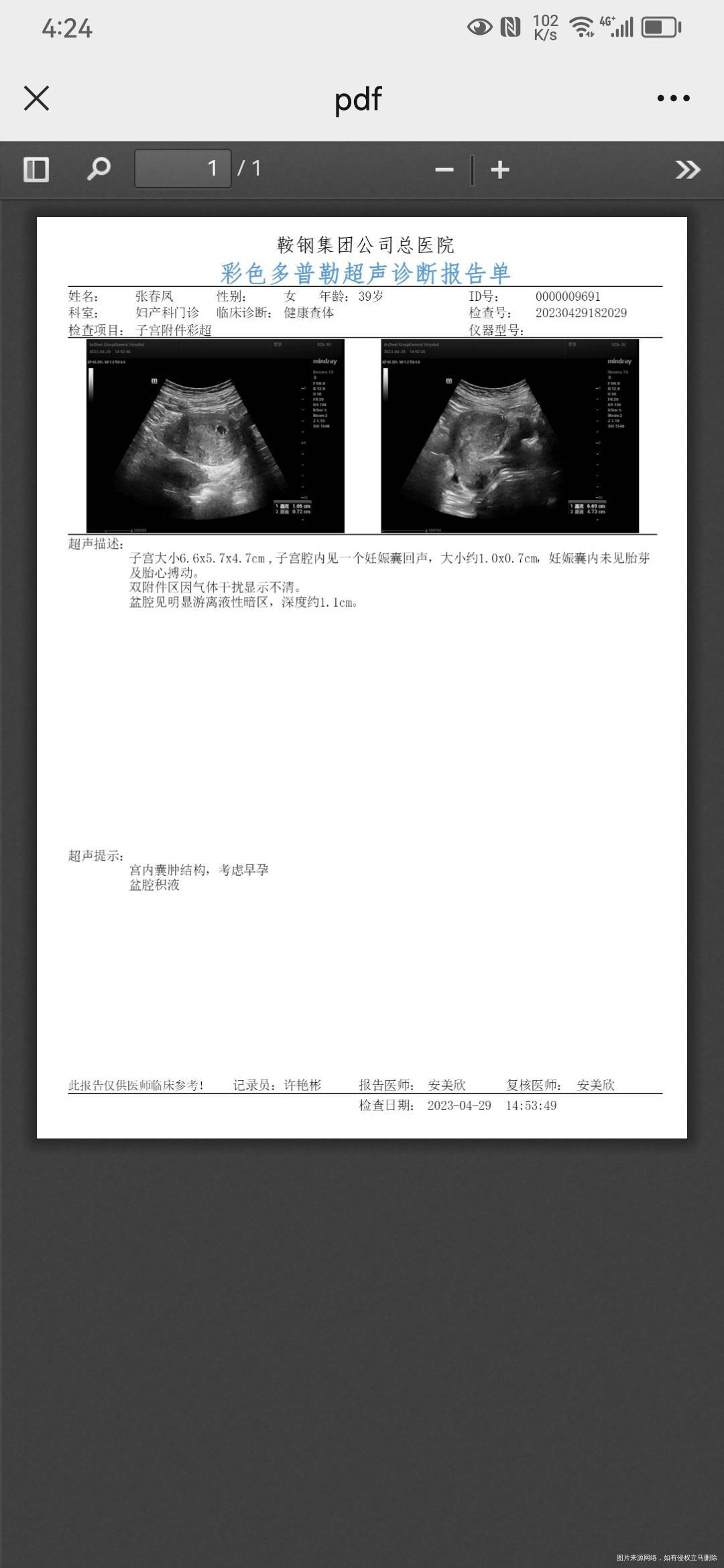 末次月经321五周三天也就是4月29日血值和
