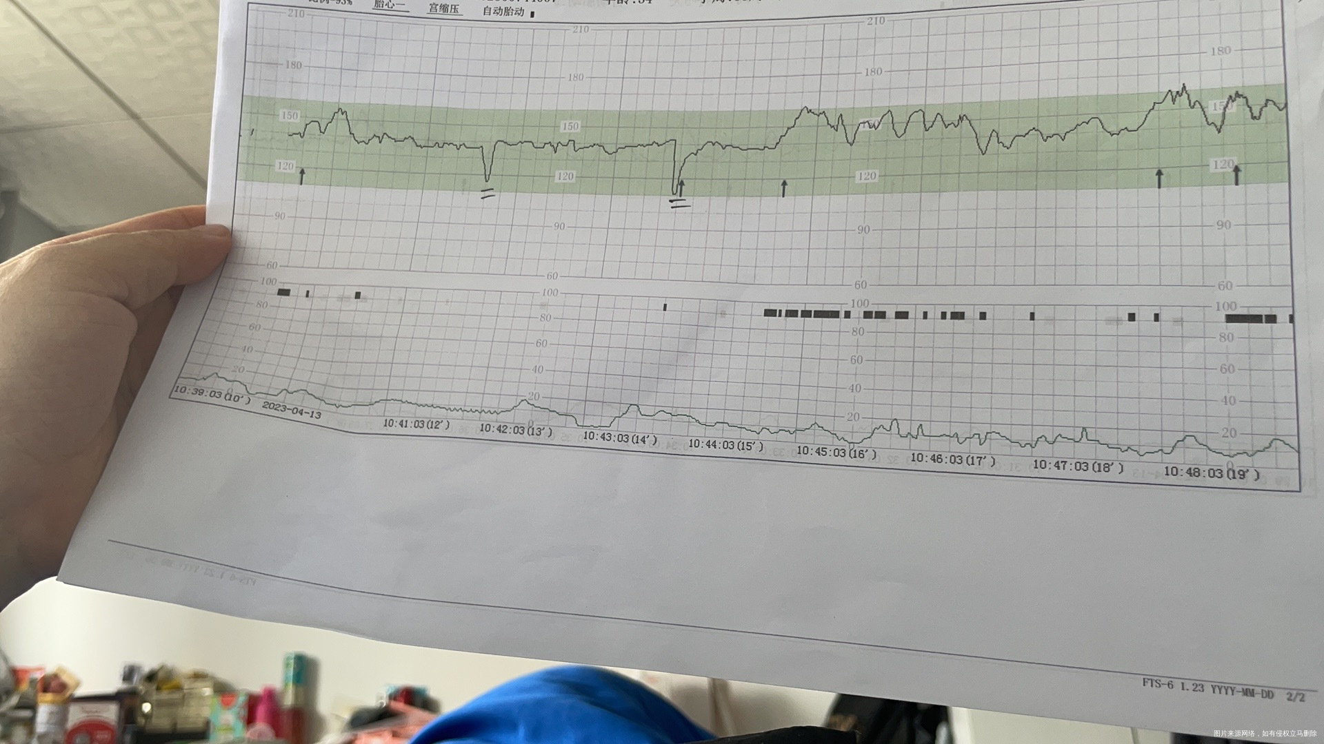 孕34周今天的胎心监测画等号的是啥意思啊麻烦