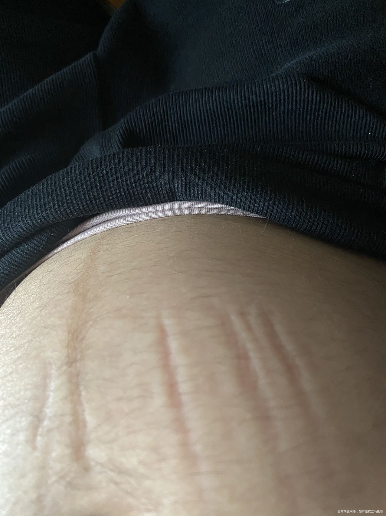 孕22周穿孕妇裤松紧带调结大小的每次都勒到肚