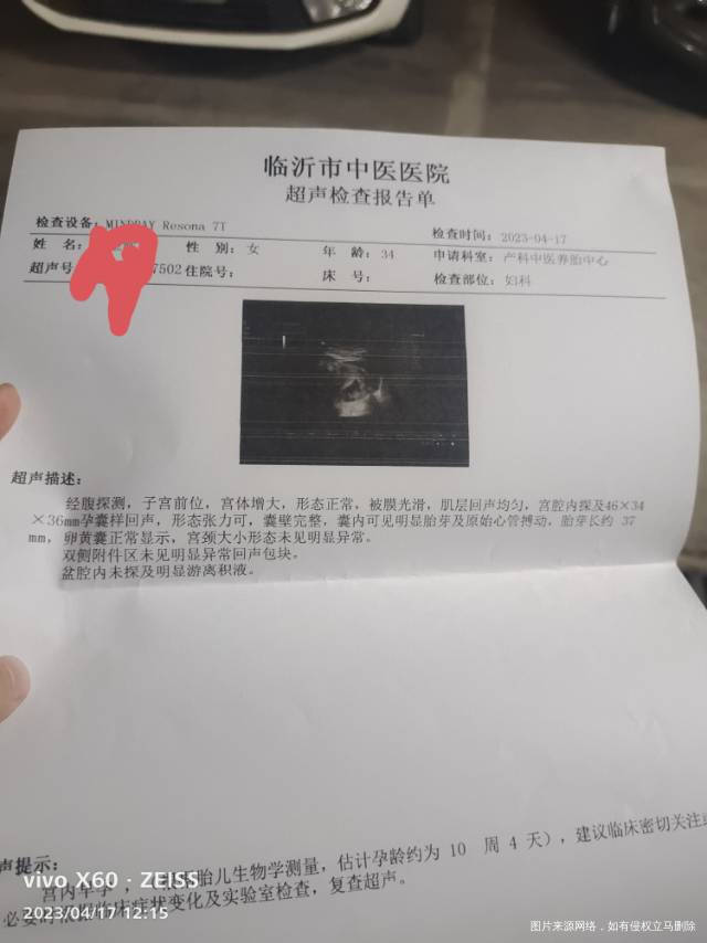 孕九加四过了一星期十加四孕囊不涨只涨胎芽这样