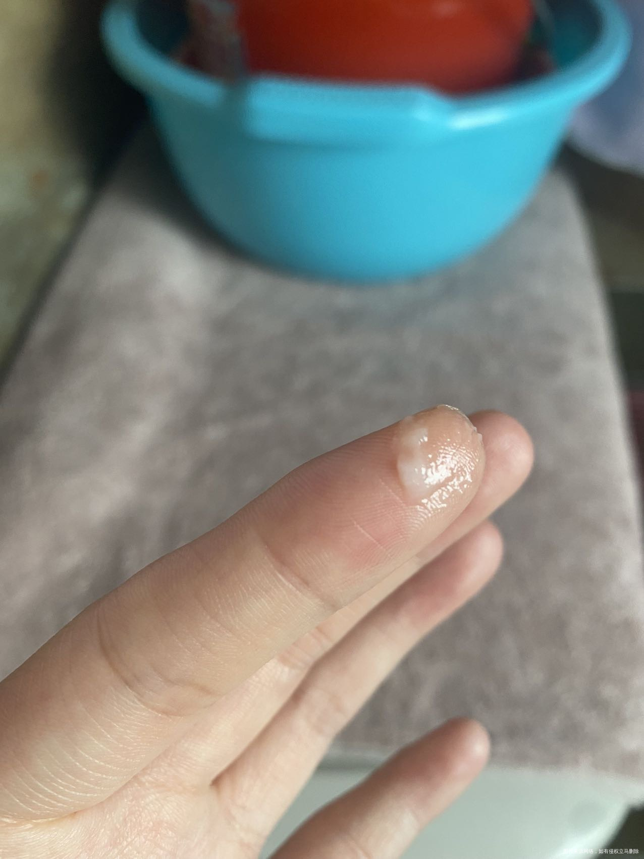 25周➕1下面有这种分泌物正常吗