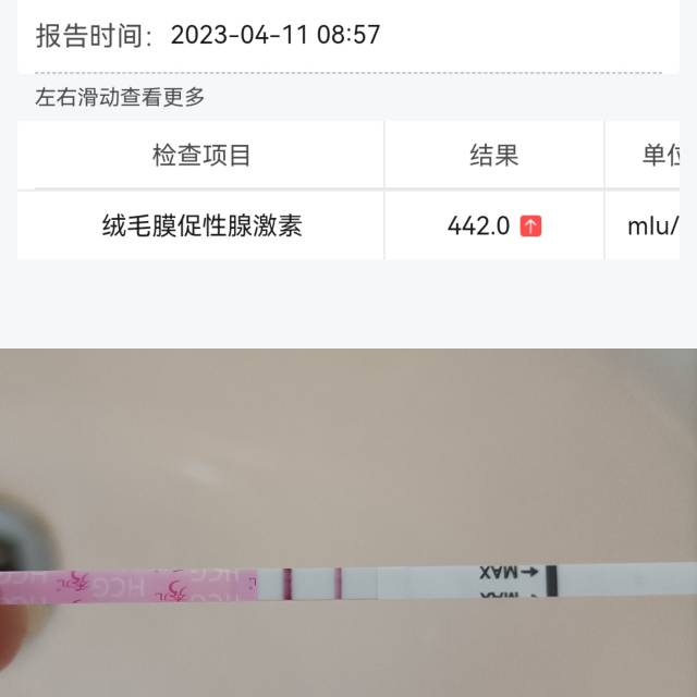 医生移植囊胚d12天含移植日第8天HCG10