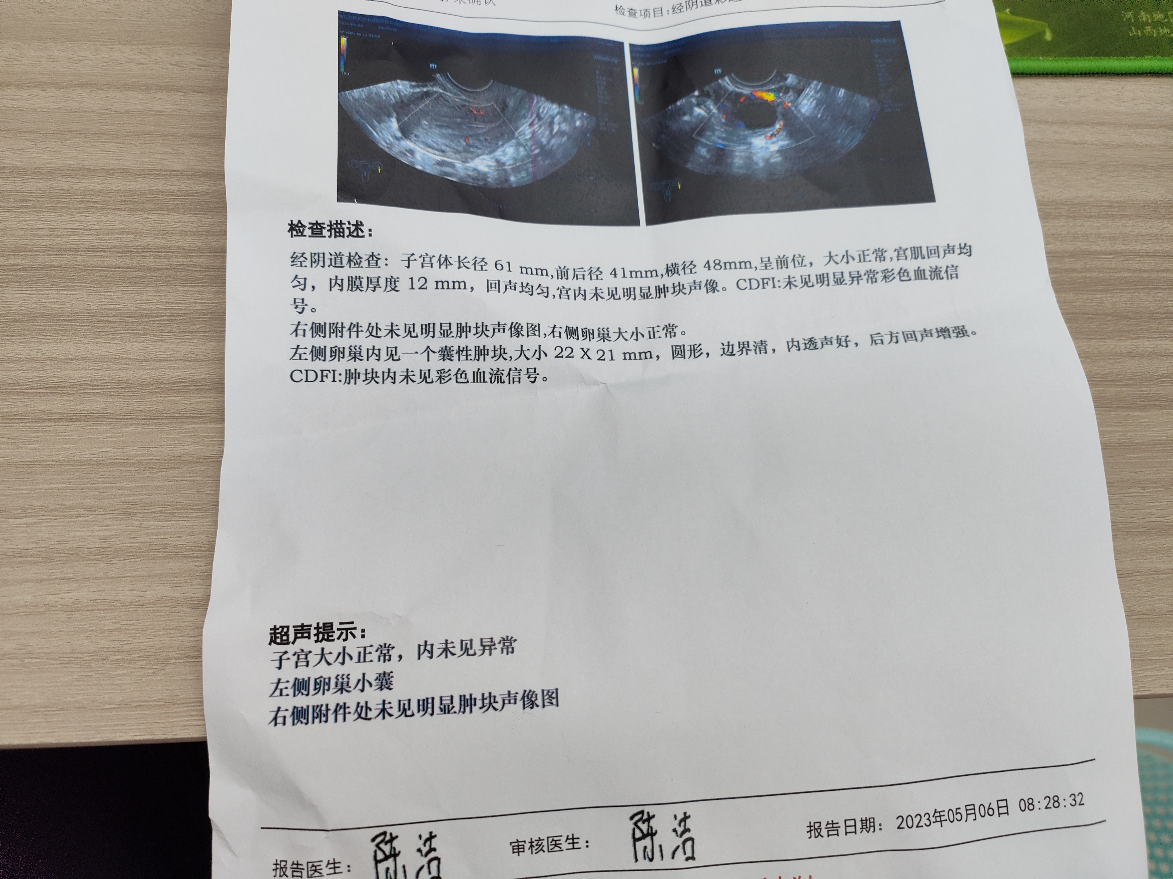 4月22生化后来了5天月经按周期算是明天的排