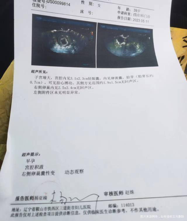 孕七周的彩超突然发现右卵巢囊性变有点儿担心这