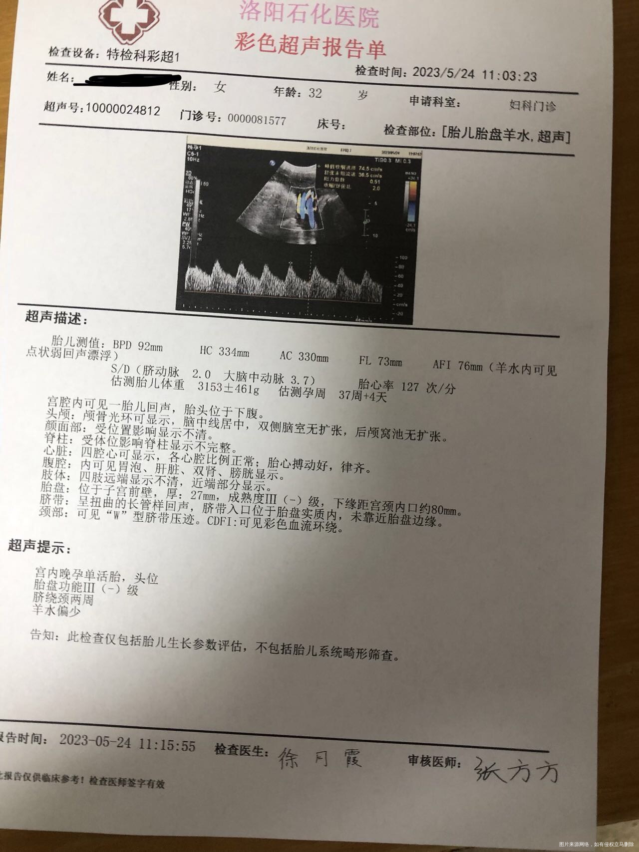 急急急孕38+3今天做的彩超严重吗是否需要剖