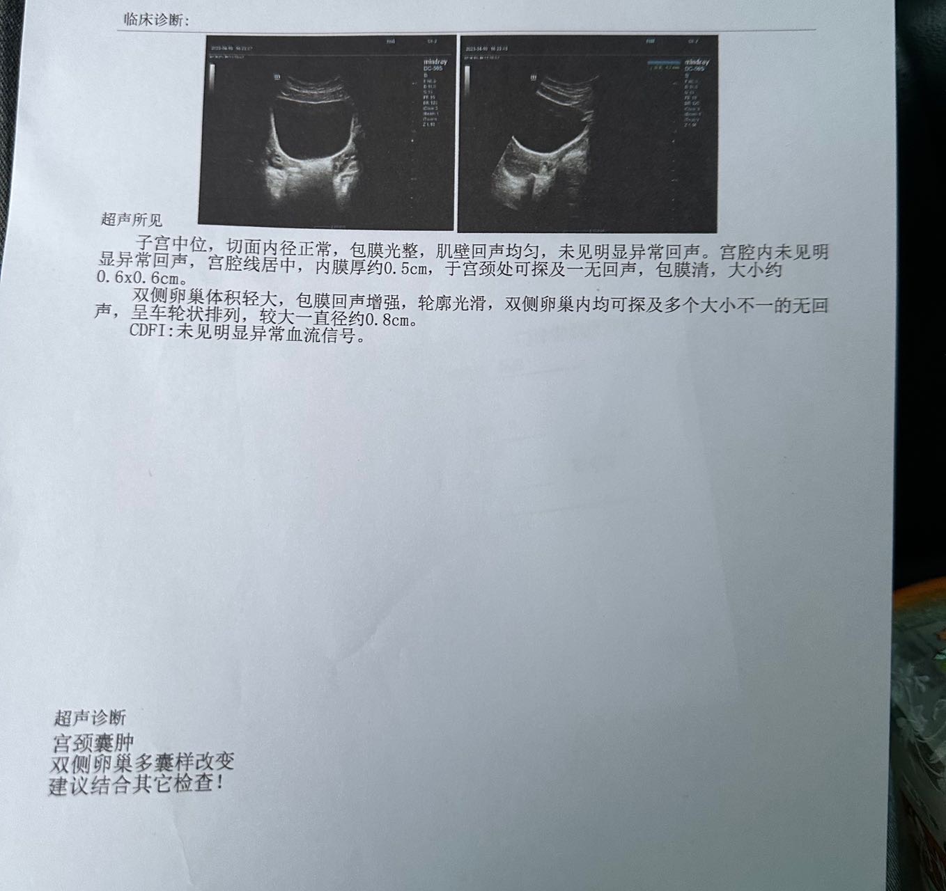 医生您好我是从今年开始月经不调去检查了一下说