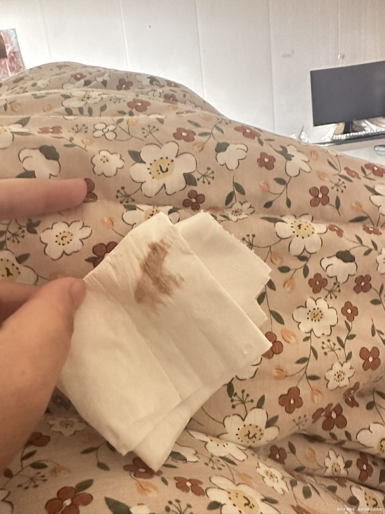 试管双胎21周有血20周的时候出鲜血住院了b