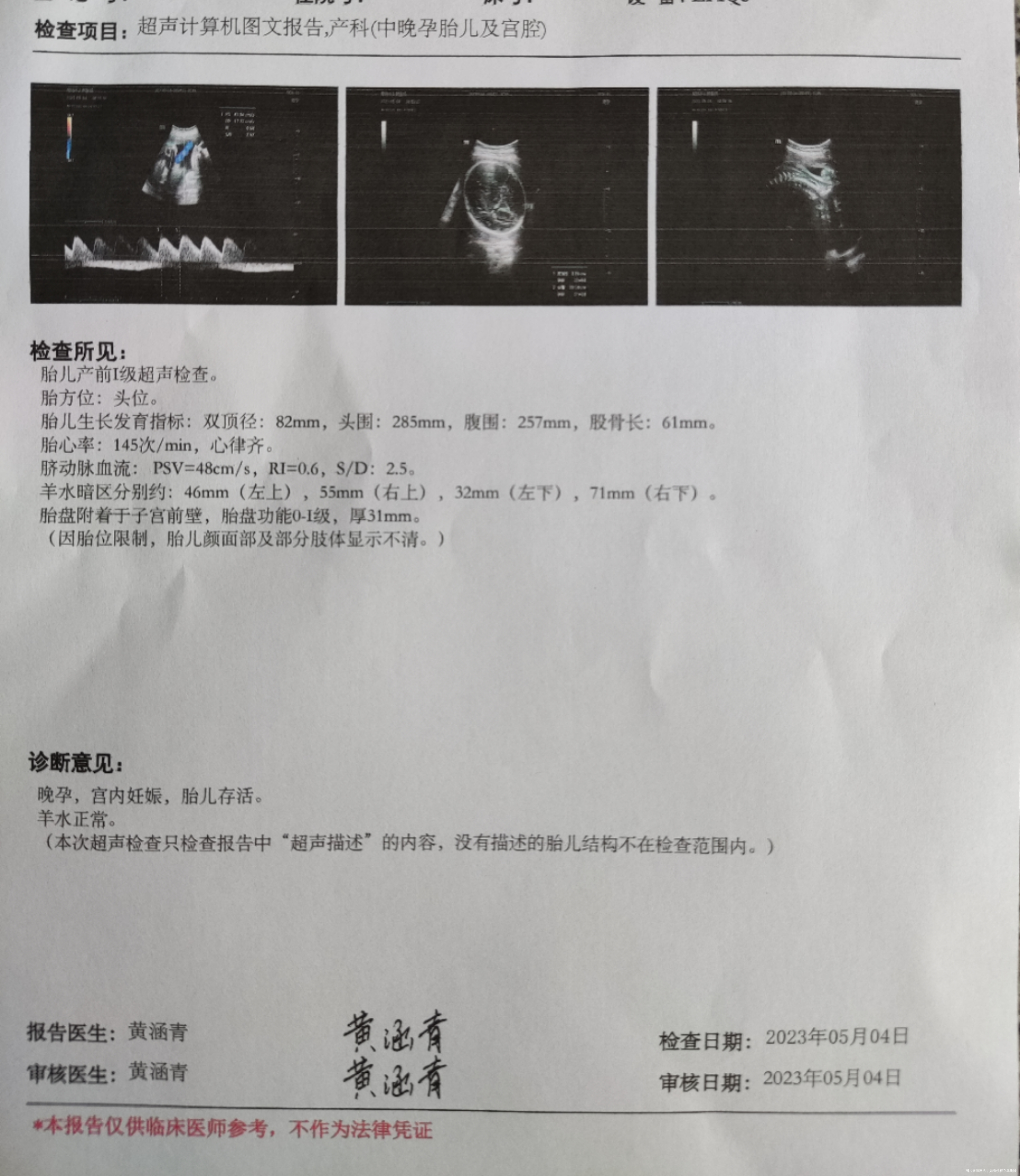 医生您好我孕30周末次月经是22107每次b