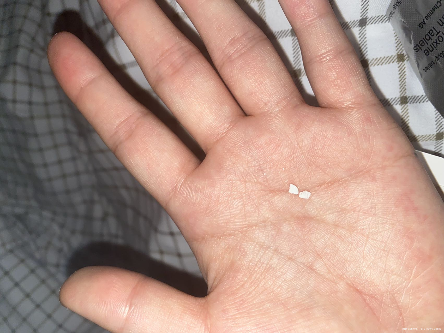 32周吃的左甲状腺素片吃完了在医院开原是粉色