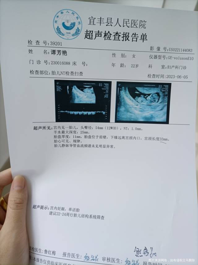 怀孕13周昨晚肚子疼了一会大概2分钟疼一次疼