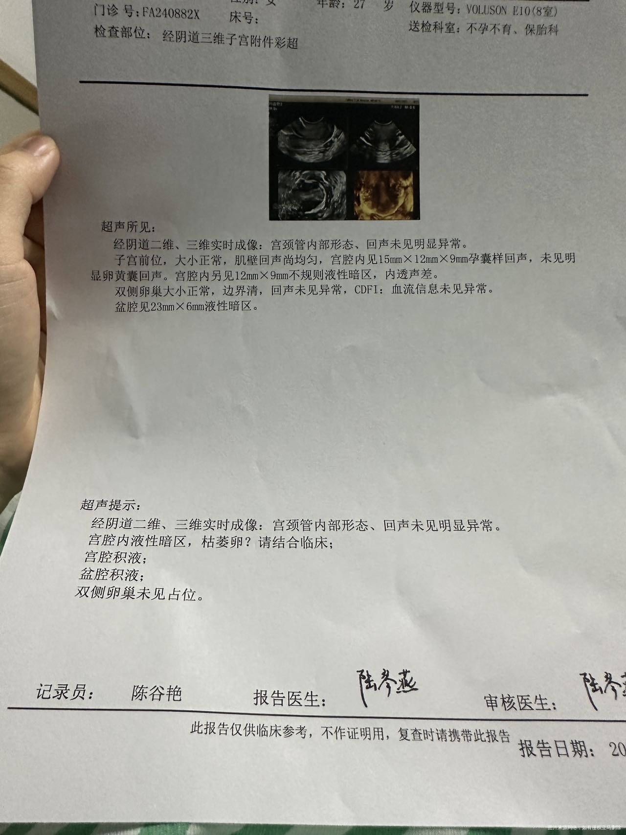 hcg卡9000的时候卡住不动了后续到医院治