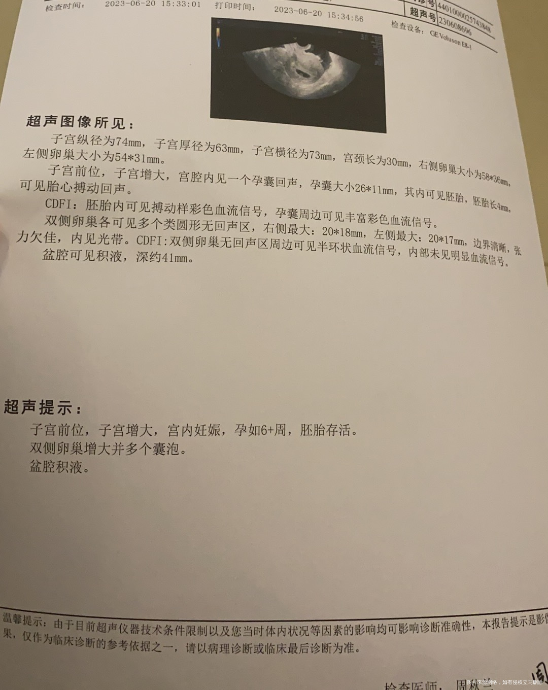 请问6周的b超单正常吗