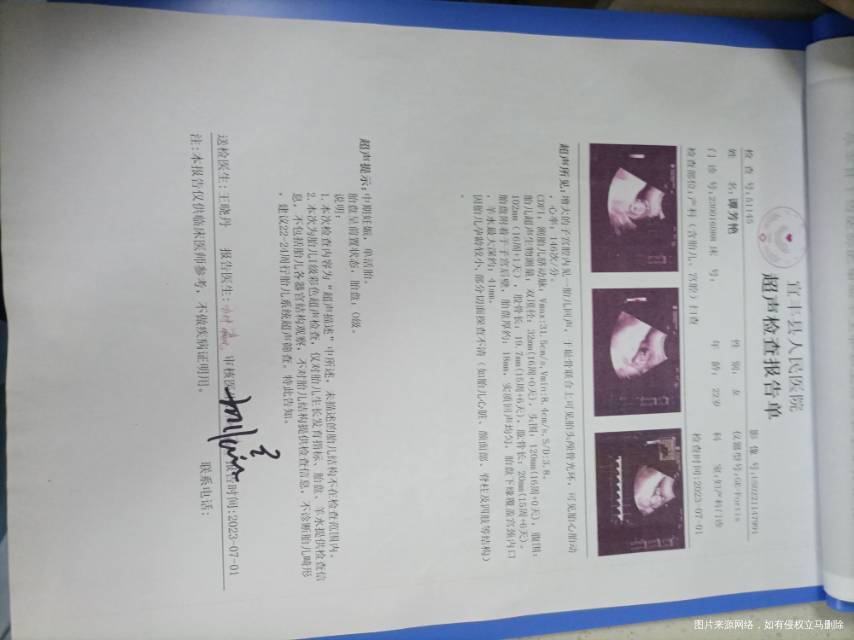 医生我刚好16周凌晨有水样褐色分泌物流出来挺