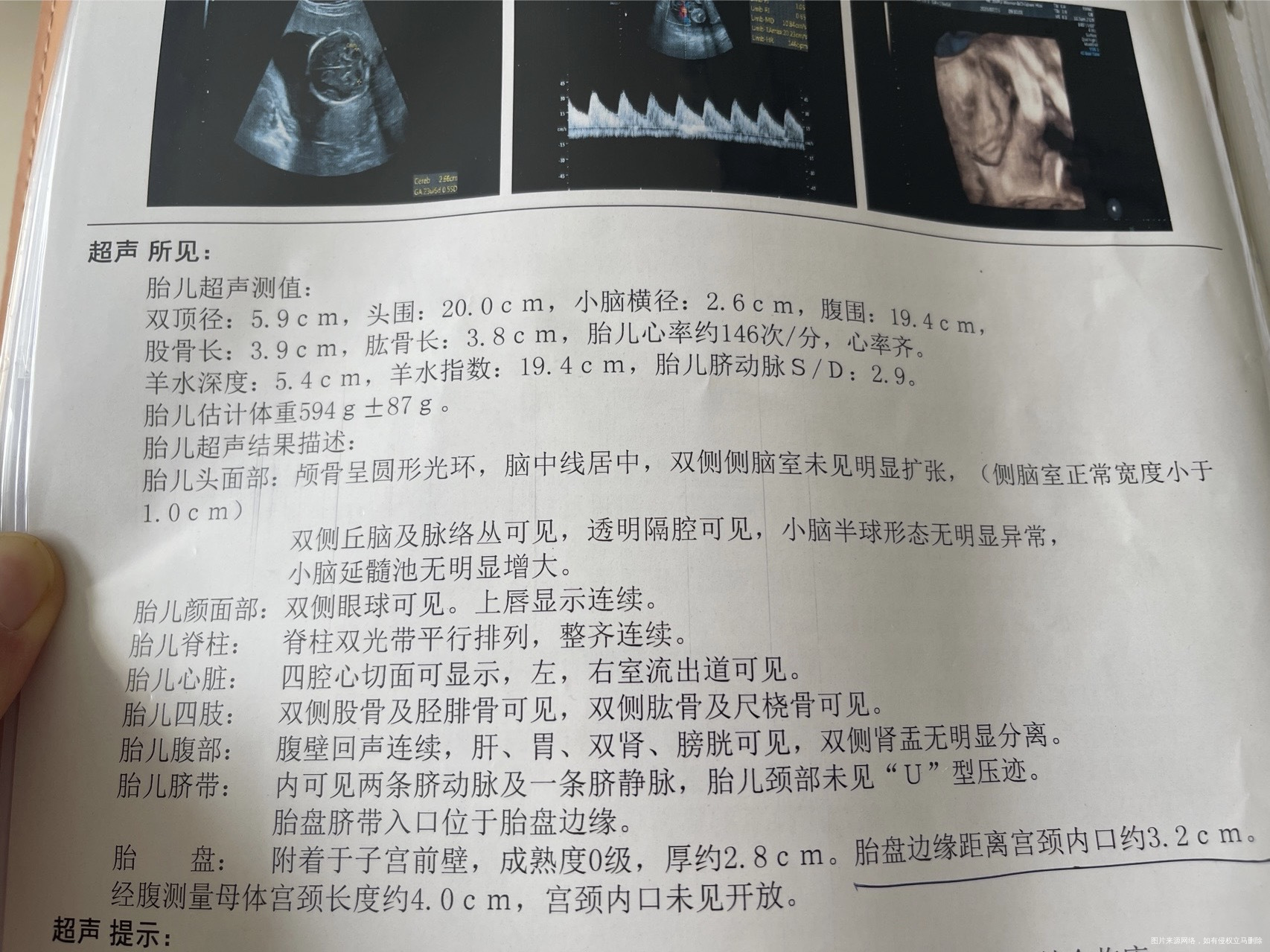 末次月经2月8日b超预估孕周23+2麻烦帮忙