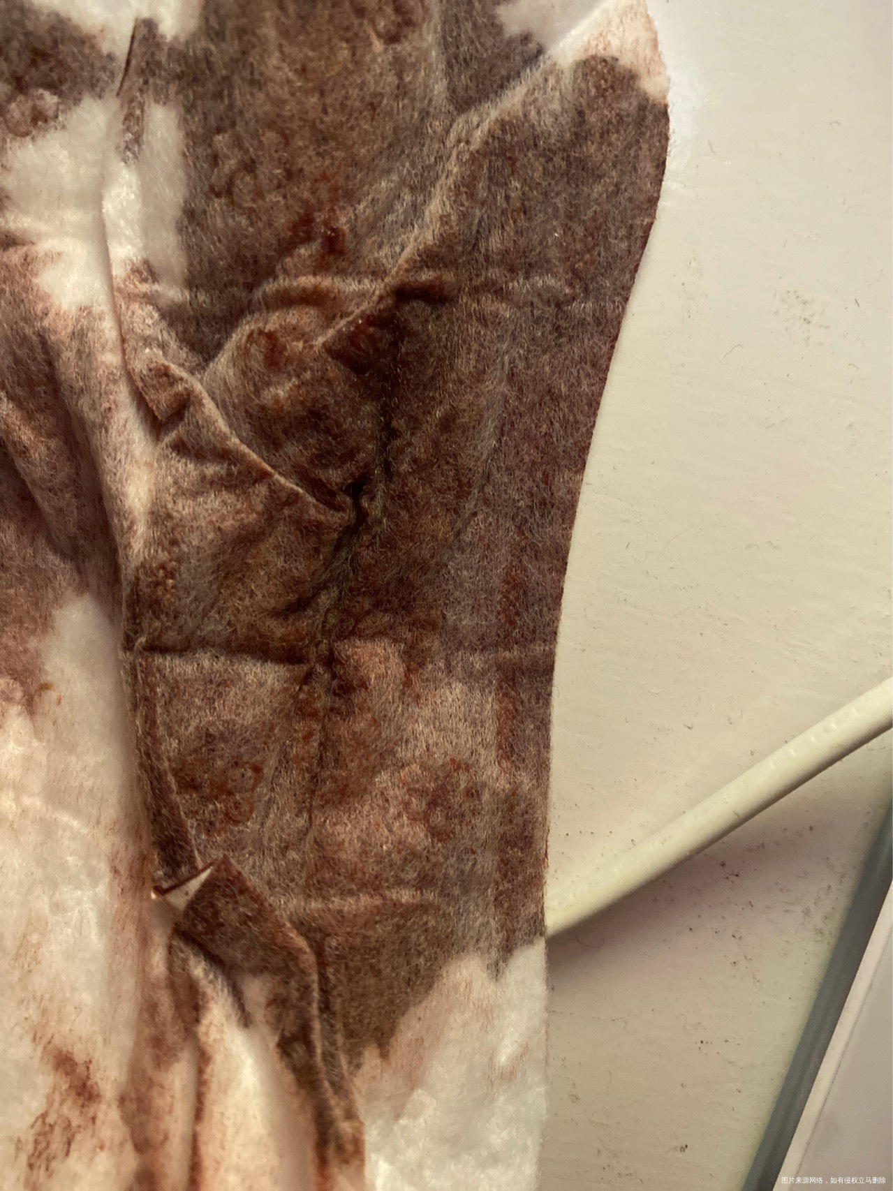 剖腹产14天这几天下面都干净了刚半夜突然又一