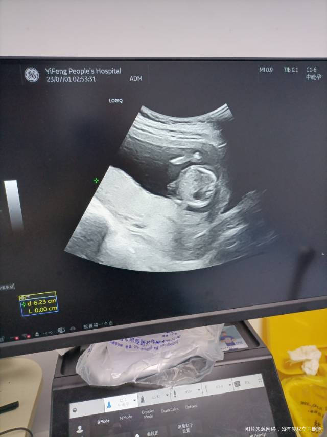 医生我刚好16周凌晨有水样褐色分泌物流出来挺