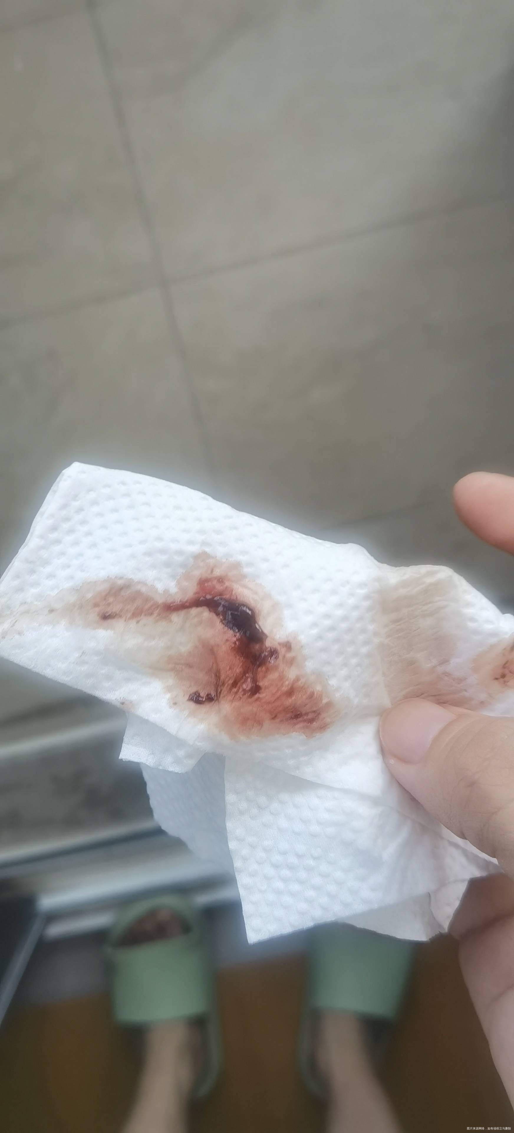 医生您好我现在在怀孕中目前5周+2天了还没有