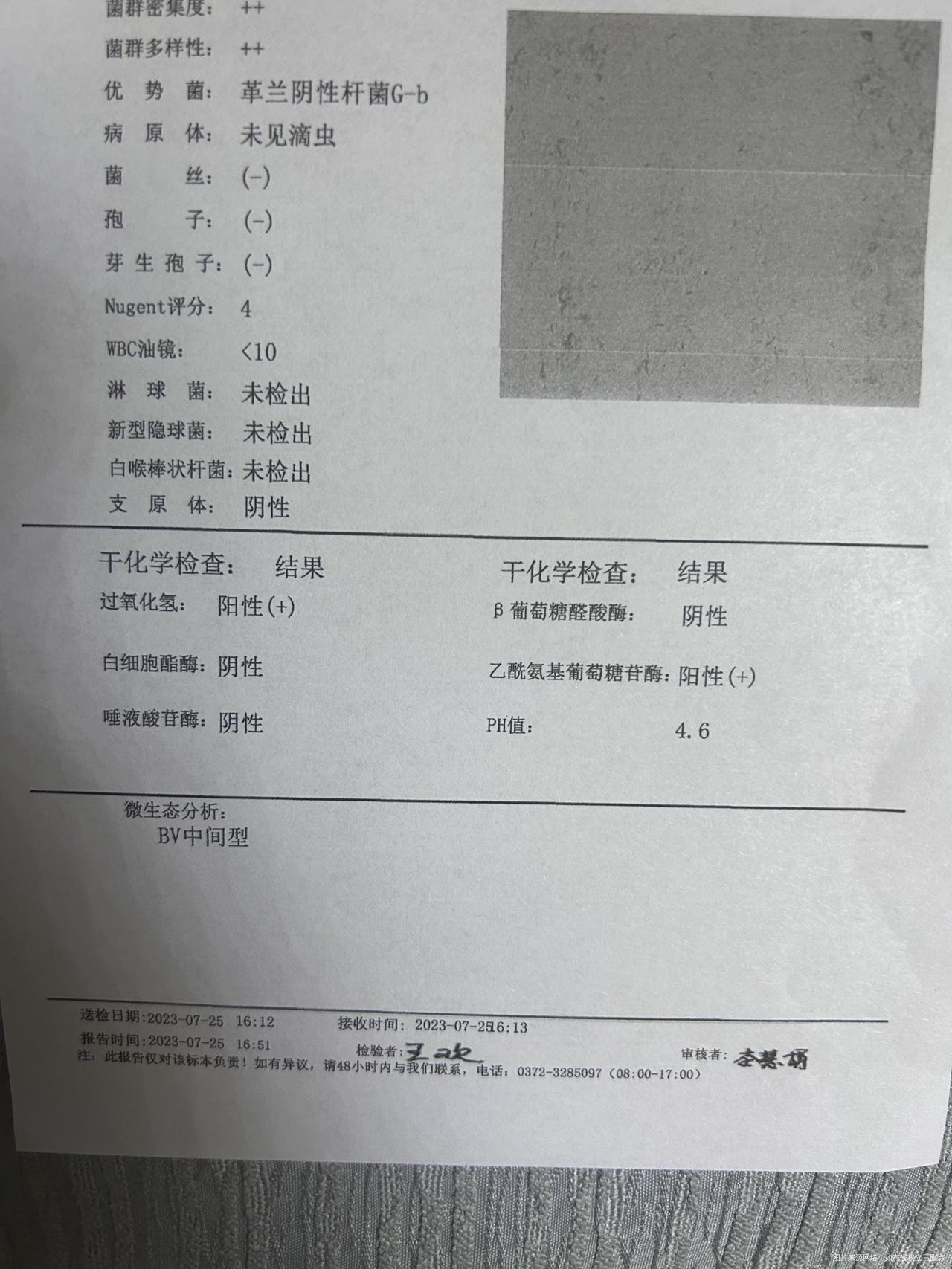 怀孕14周查了白带帮忙看一下结果用塞药吗宫颈