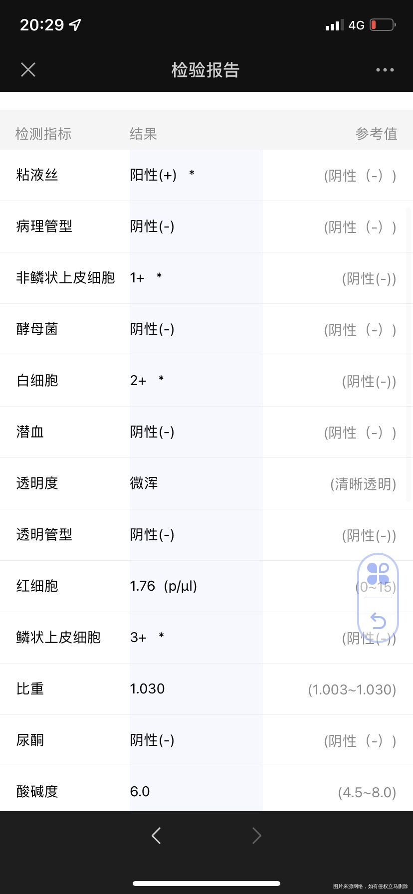 急问孕12周发现尿道感染会有尿频尿急但不会痛