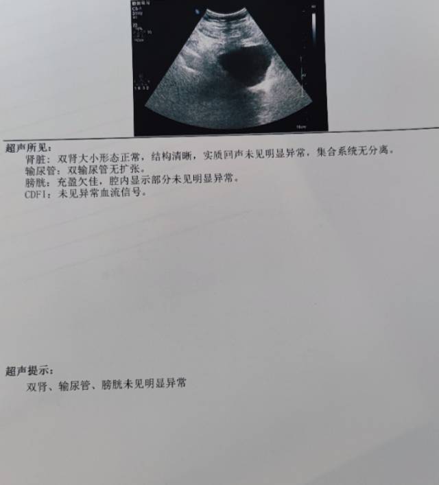 总是腰疼做了这个彩超没事吧