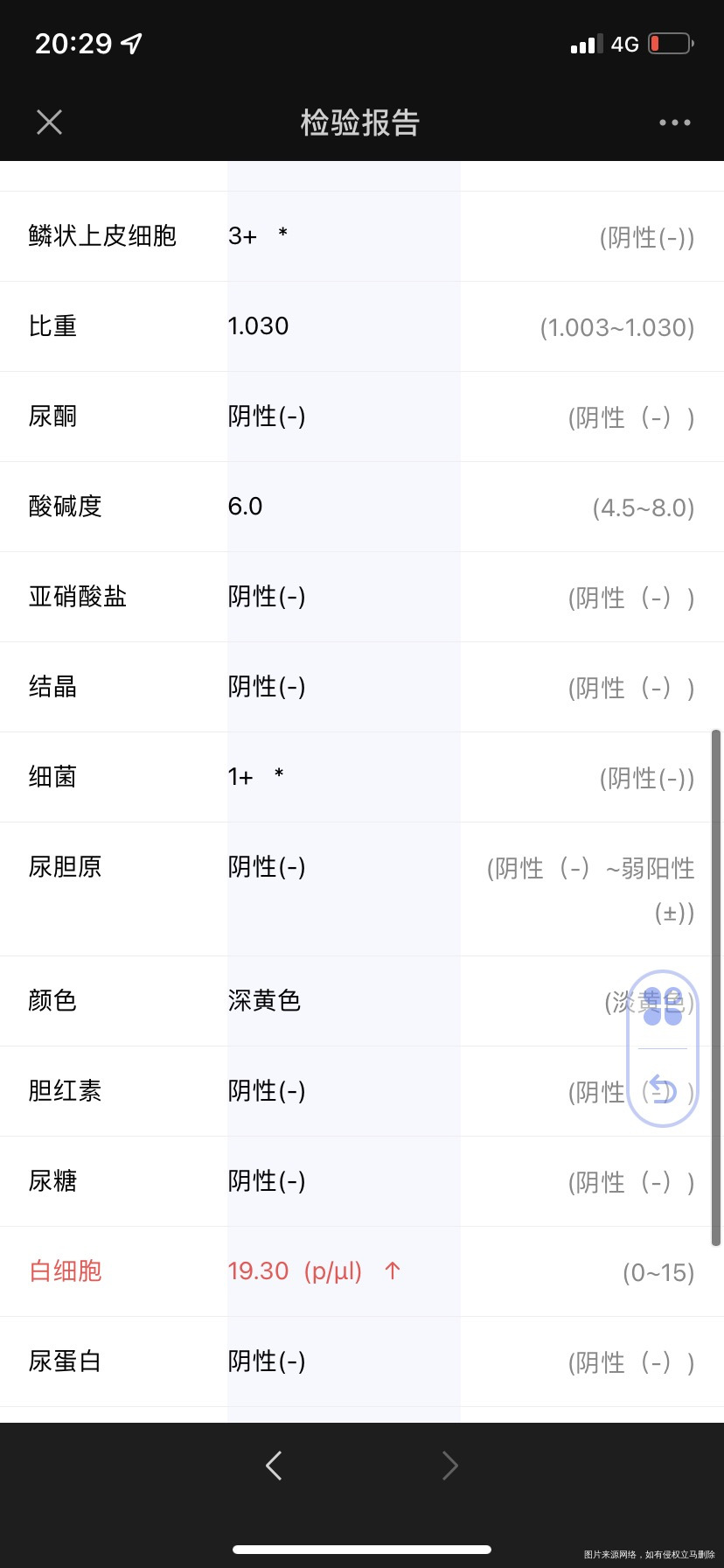 急问孕12周发现尿道感染会有尿频尿急但不会痛