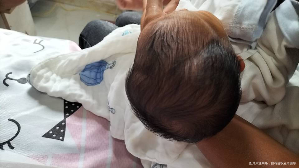 我想问下就是剖腹产第二三天发现宝宝头上豉两个