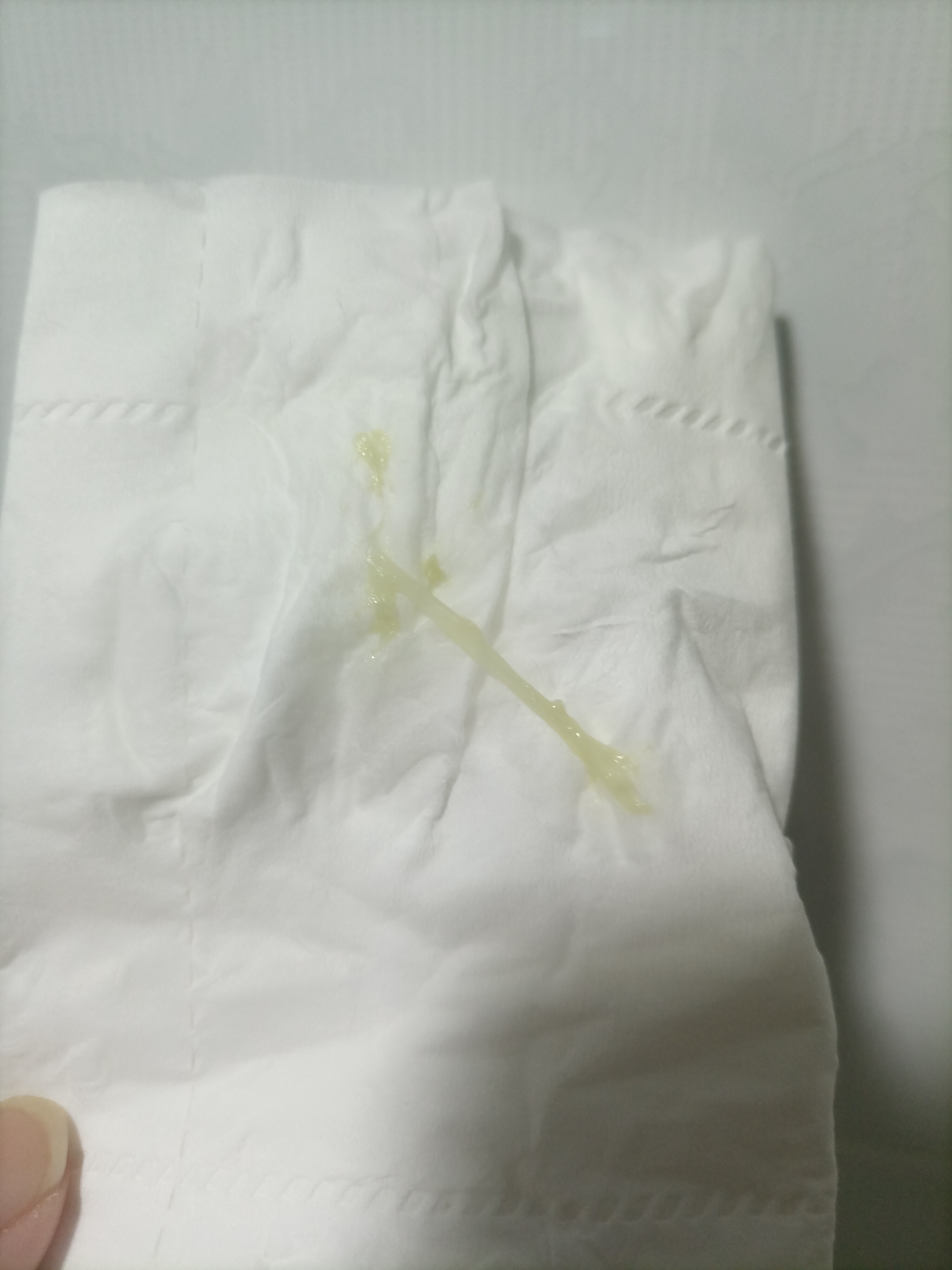 这不会是这不会是宫颈粘液栓吧孕24周昨天做四