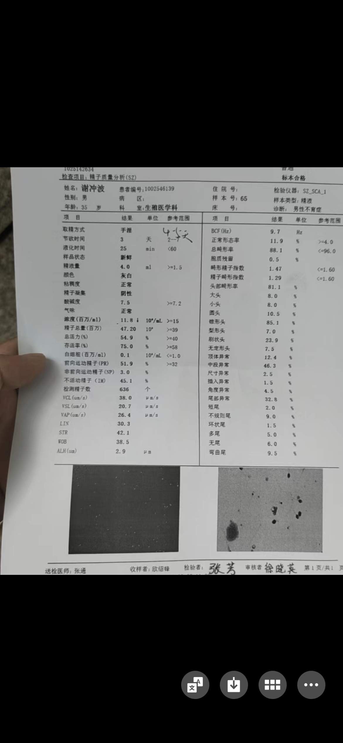 麻烦医生帮我看看每个月超声监测排卵正常月经量