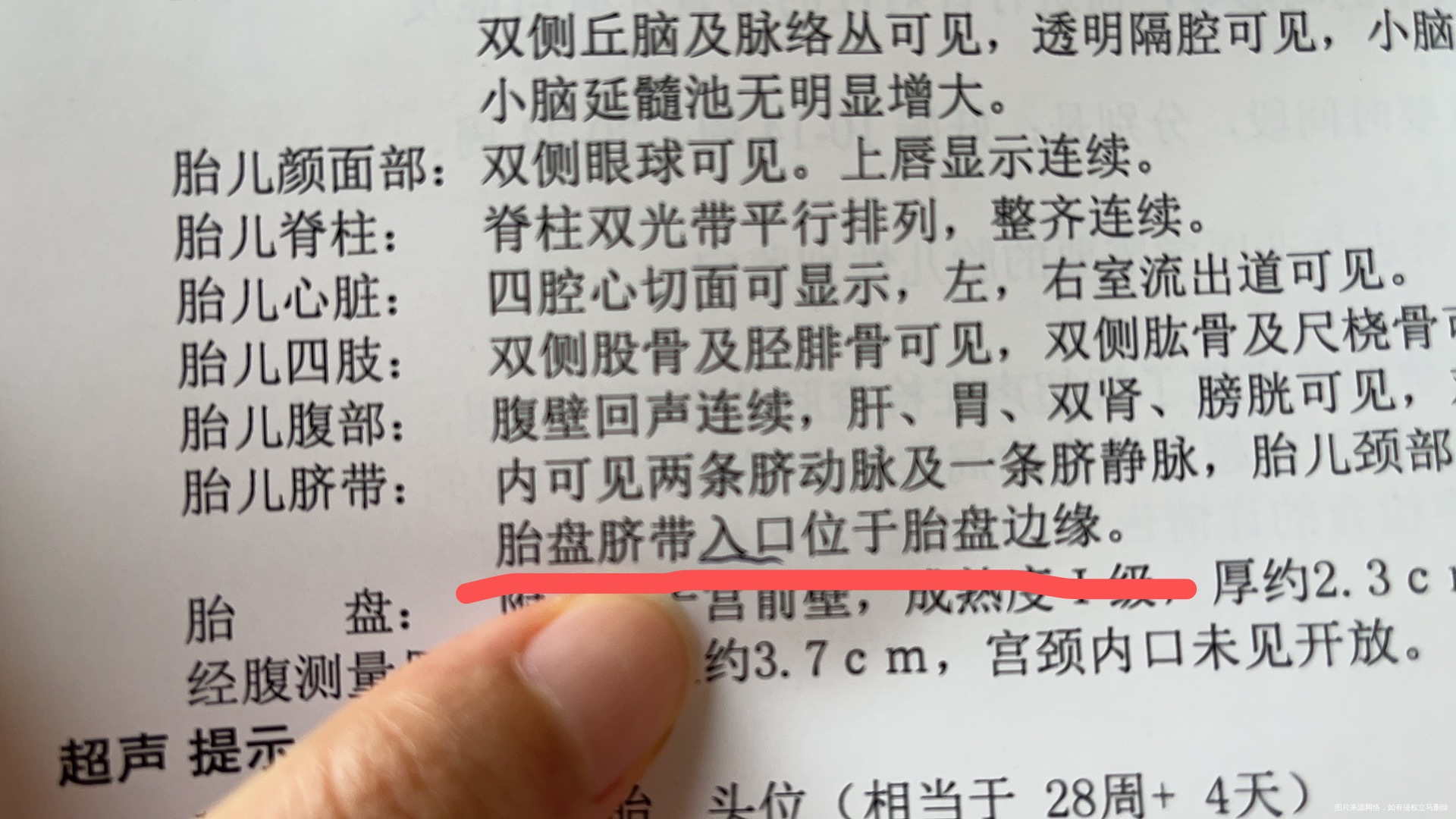 目前孕28周四维显示胎盘脐带入口位于胎盘边缘