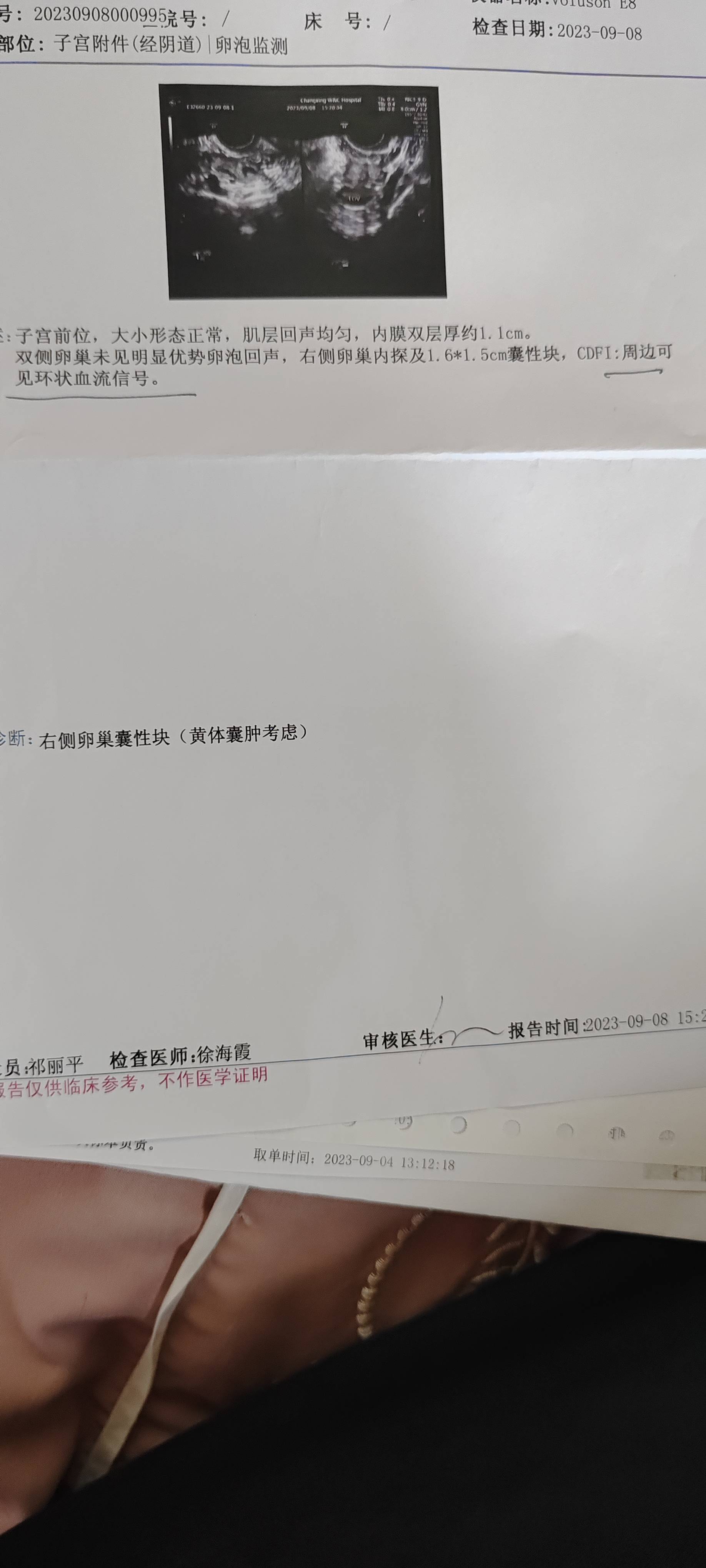 你好医生我想咨询一下排卵也正常卵泡也有优势卵