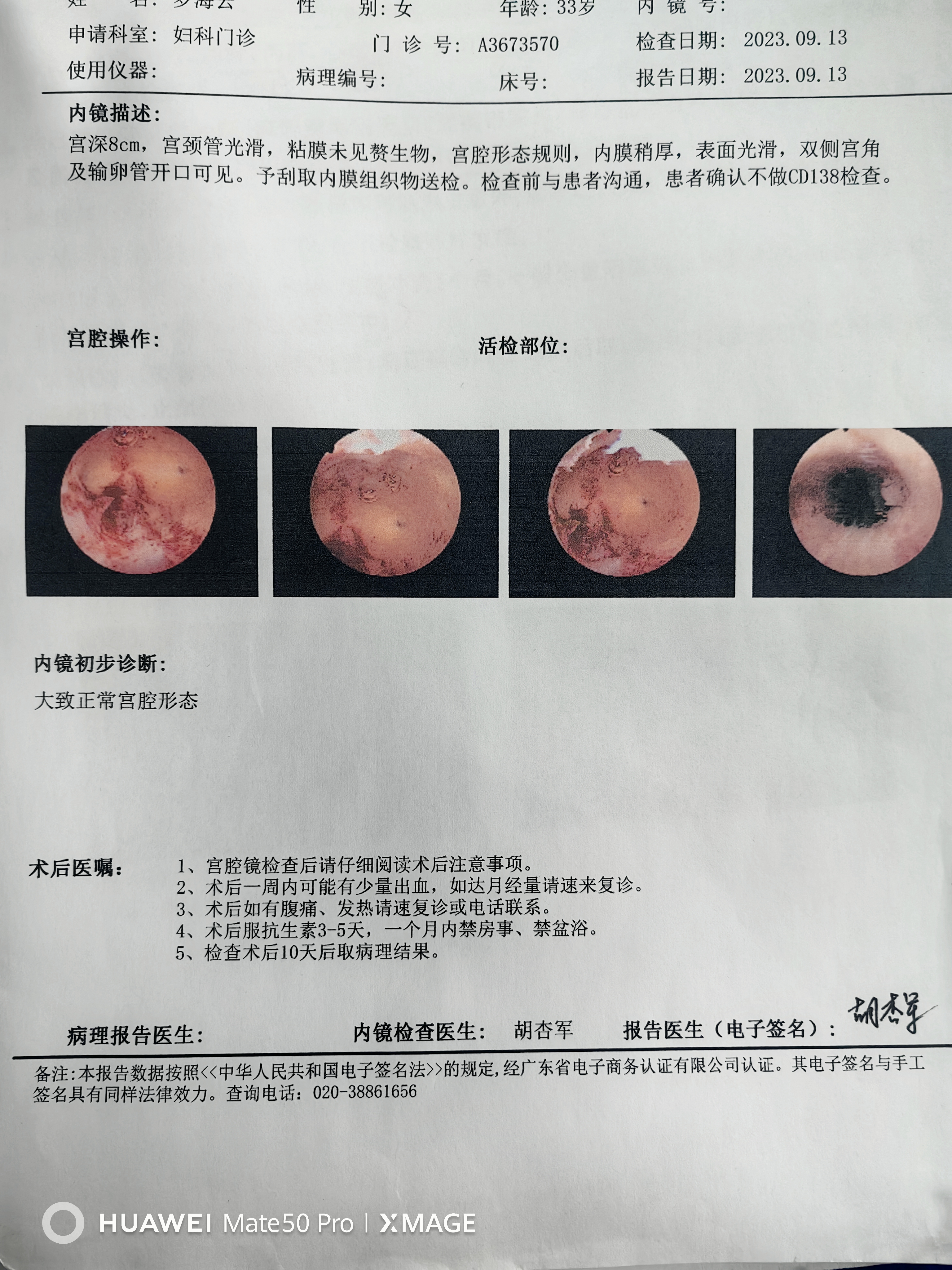 下个月准备移植这个宫腔镜检查结果正常吗