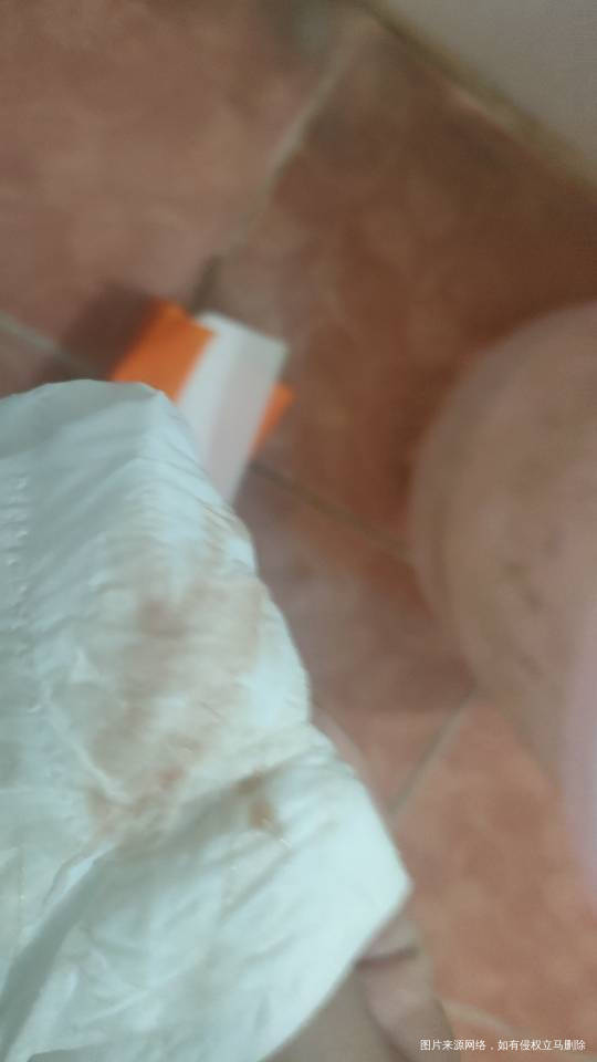 医生有这种分泌物是不是不正常我月经还没来呢上