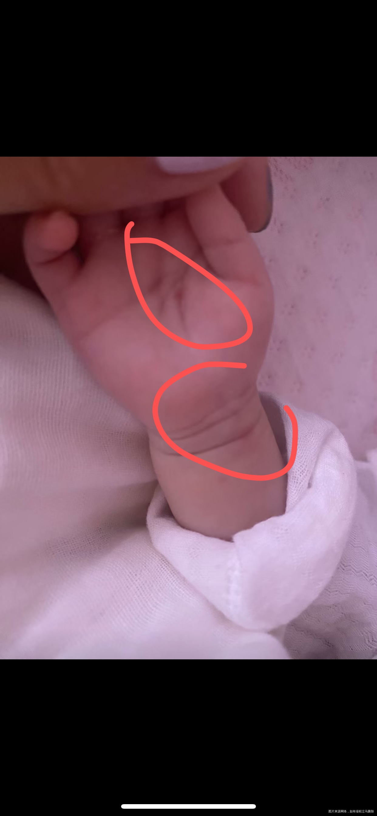 刚出生宝宝频繁拍胸片要不要紧啊一个月复查好几