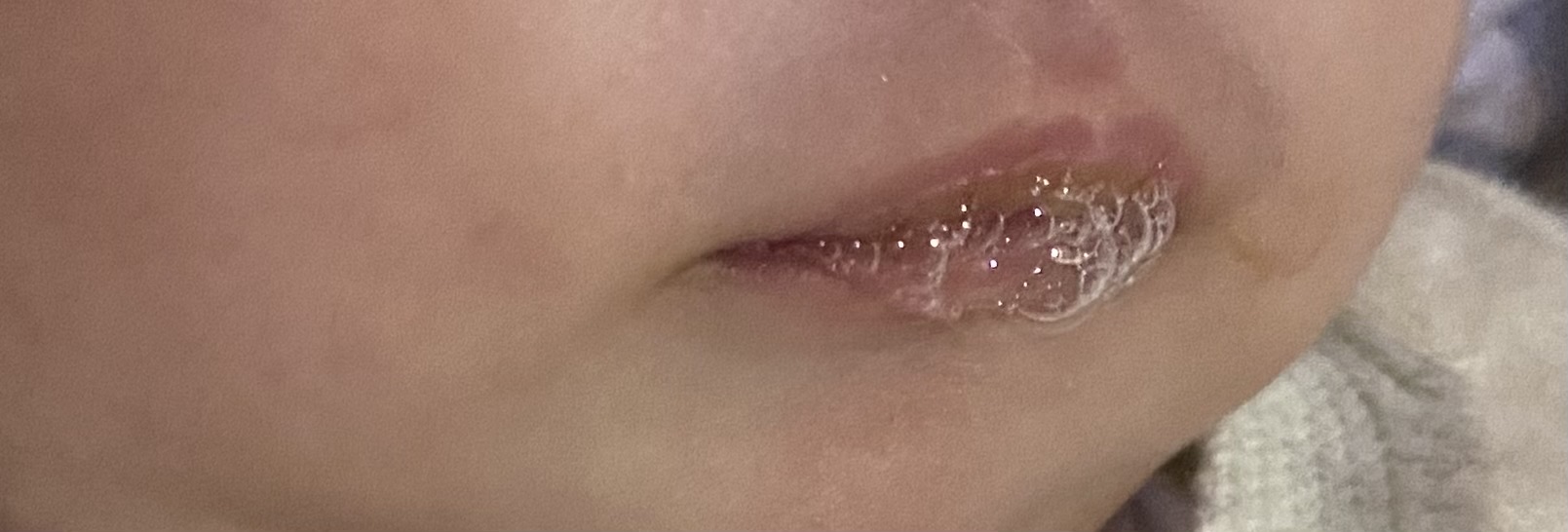 八十多天宝宝嘴巴有时候会吐泡泡这个正常吗宝宝