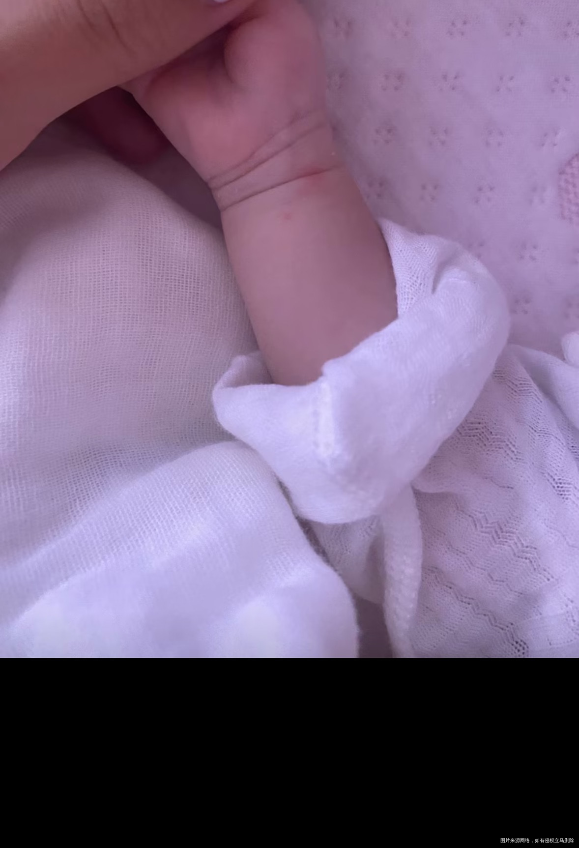 刚出生宝宝频繁拍胸片要不要紧啊一个月复查好几