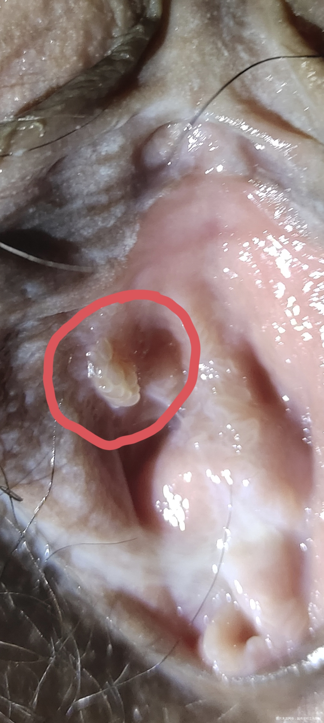 阴唇这里长了个柚子粒的东西是hpv吗10月份