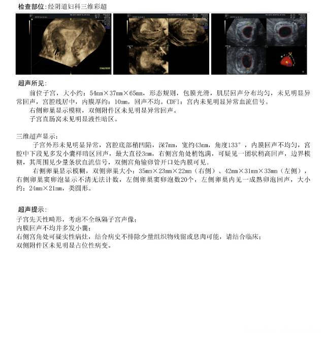 我这个三维子宫B超是造成胎儿胎停的原因吗需要