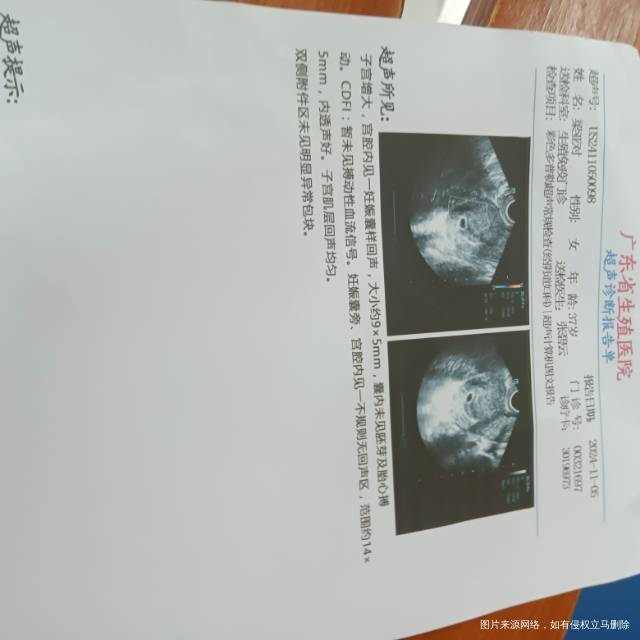 五周加四HCG翻倍不涨还有希望阴道一直流水样