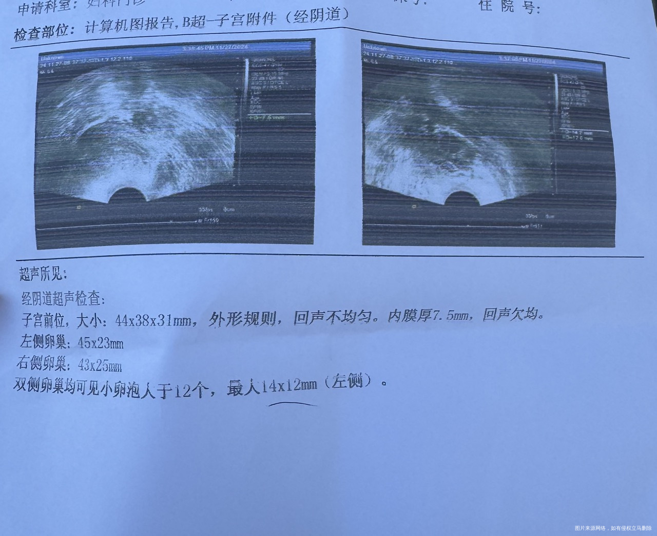 月经周期2837天不等这个月是10号来的月经