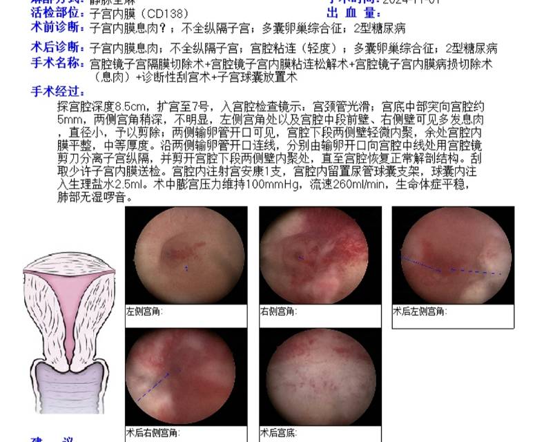 刚刚做了宫腔镜请问我这个子宫问题大吗影响怀孕