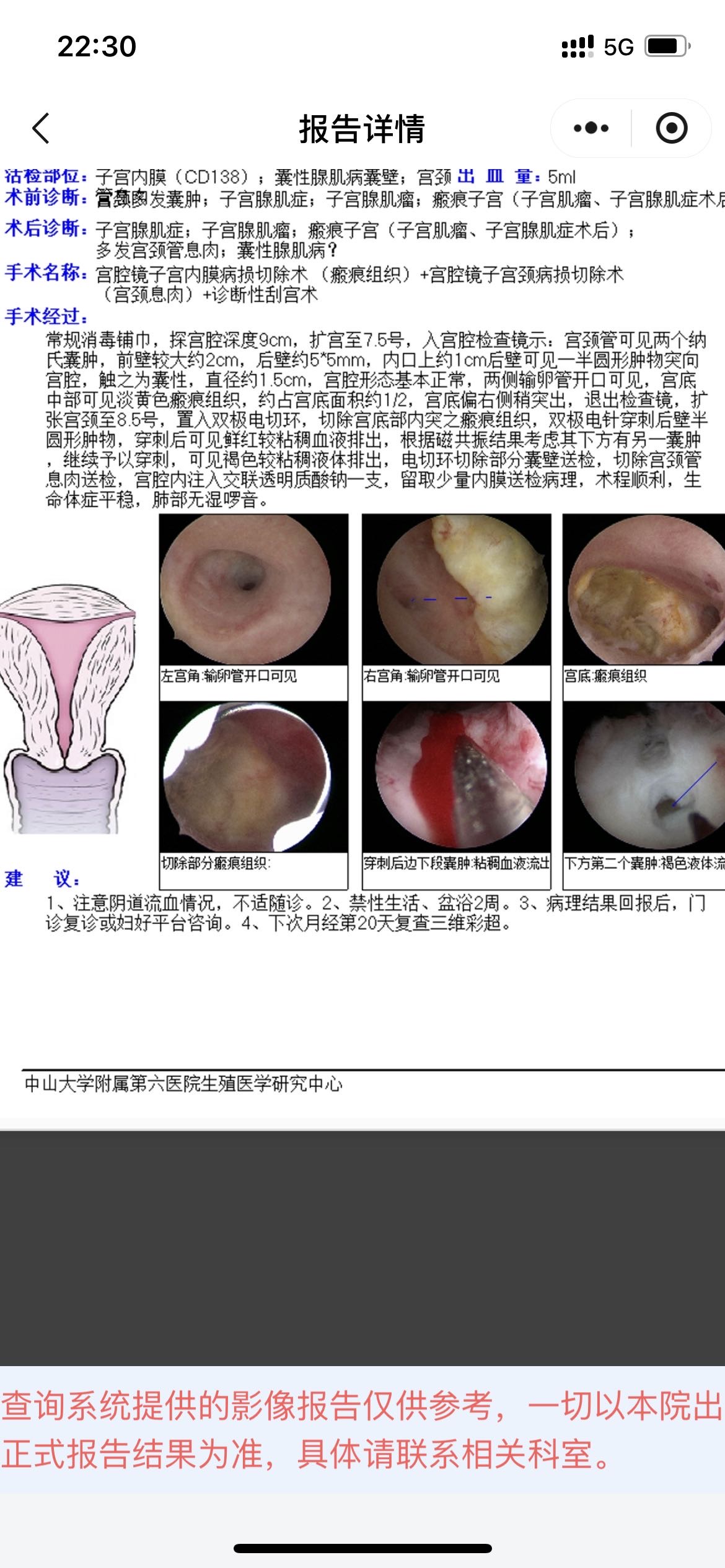 刚才提问腺肌症宫腔镜的图片