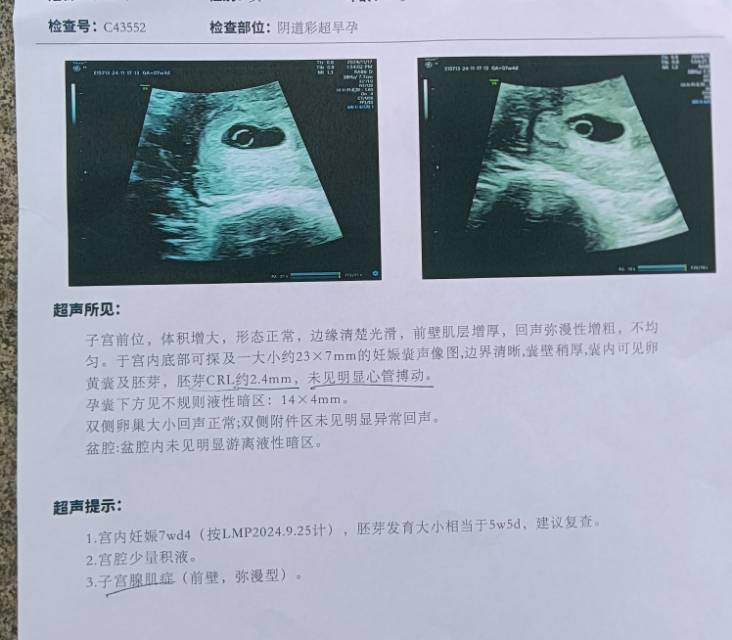 八周无胎心还有希望吗
