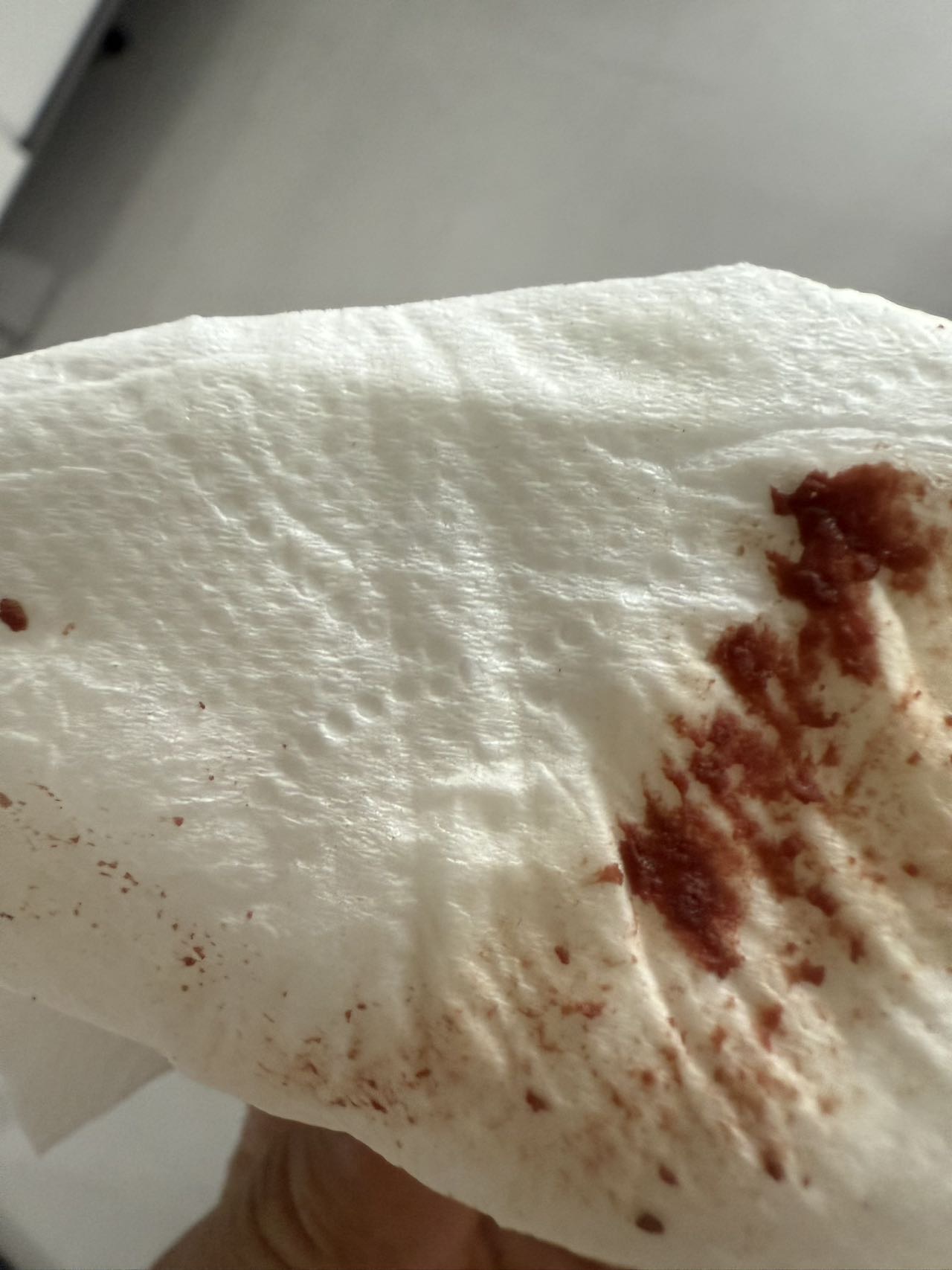 月经第五天结束了小便后擦出渣类是什么第一次遇