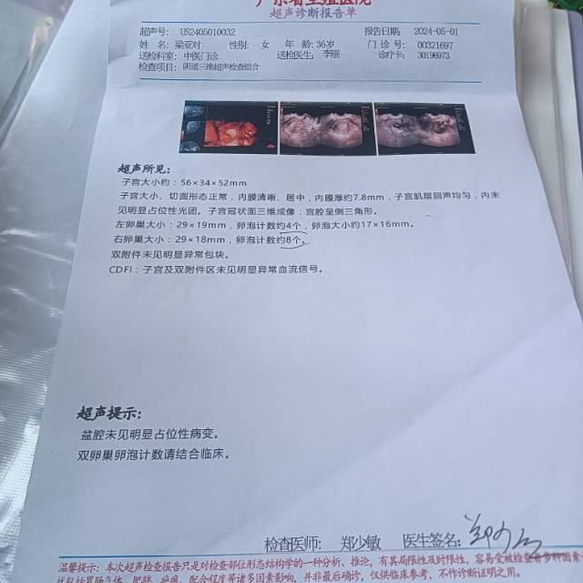 医生你好月经量少从三维看有宫腔粘连吗激素六项