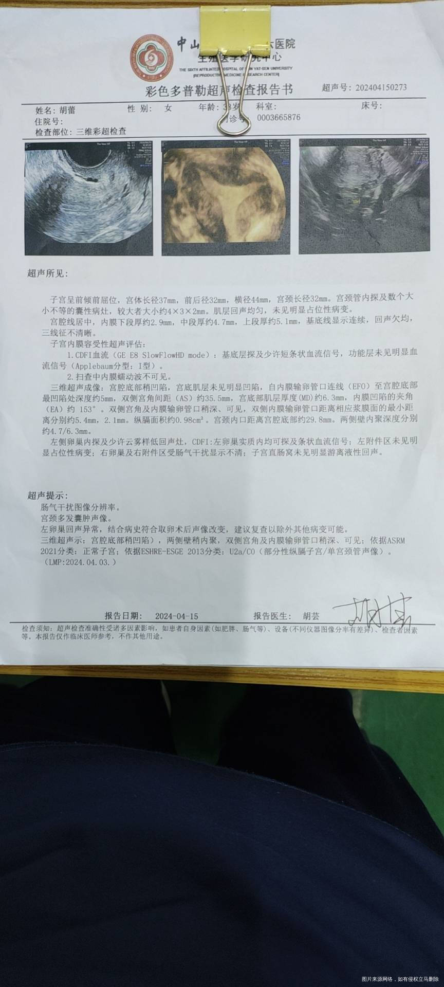 第一张是去年试管建档时候做的三维彩超医生说有