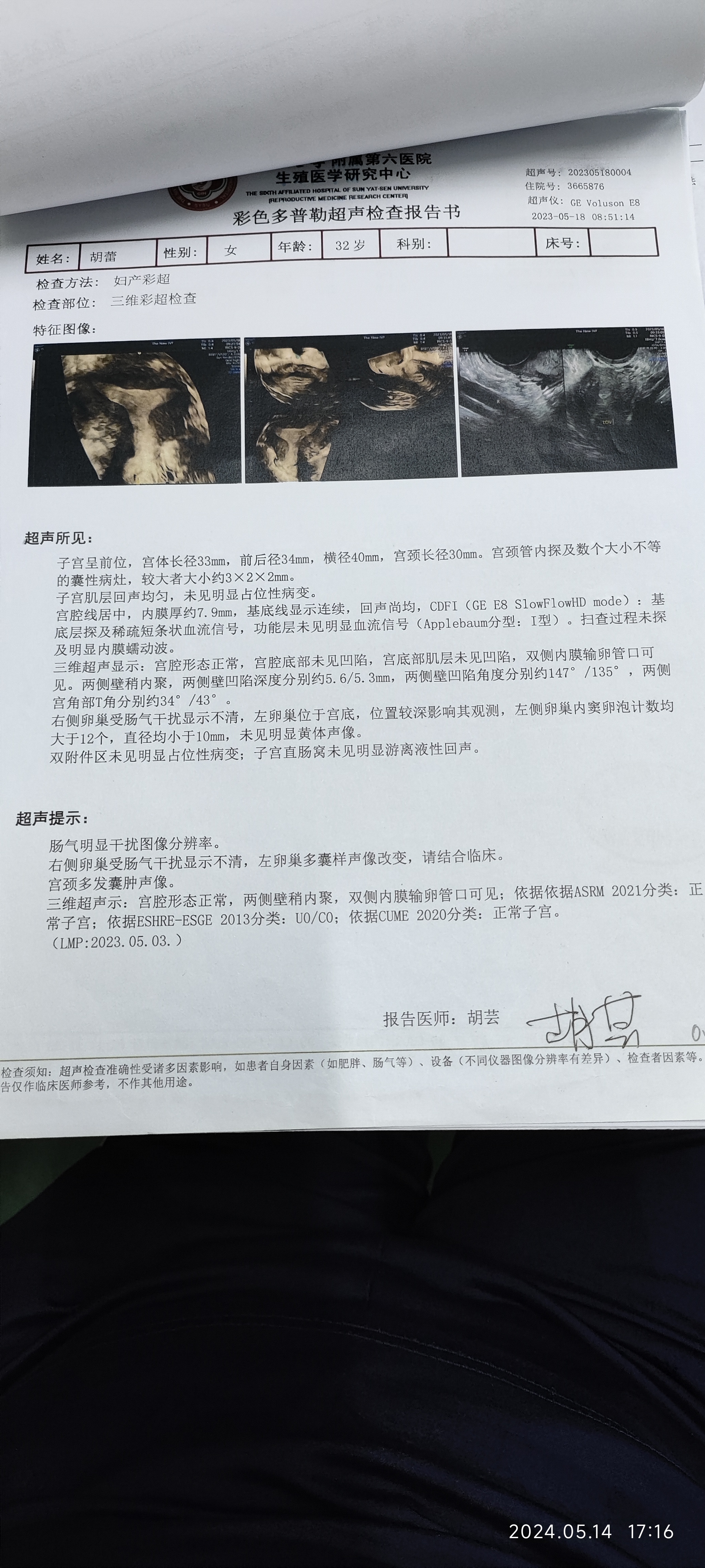 第一张是去年试管建档时候做的三维彩超医生说有