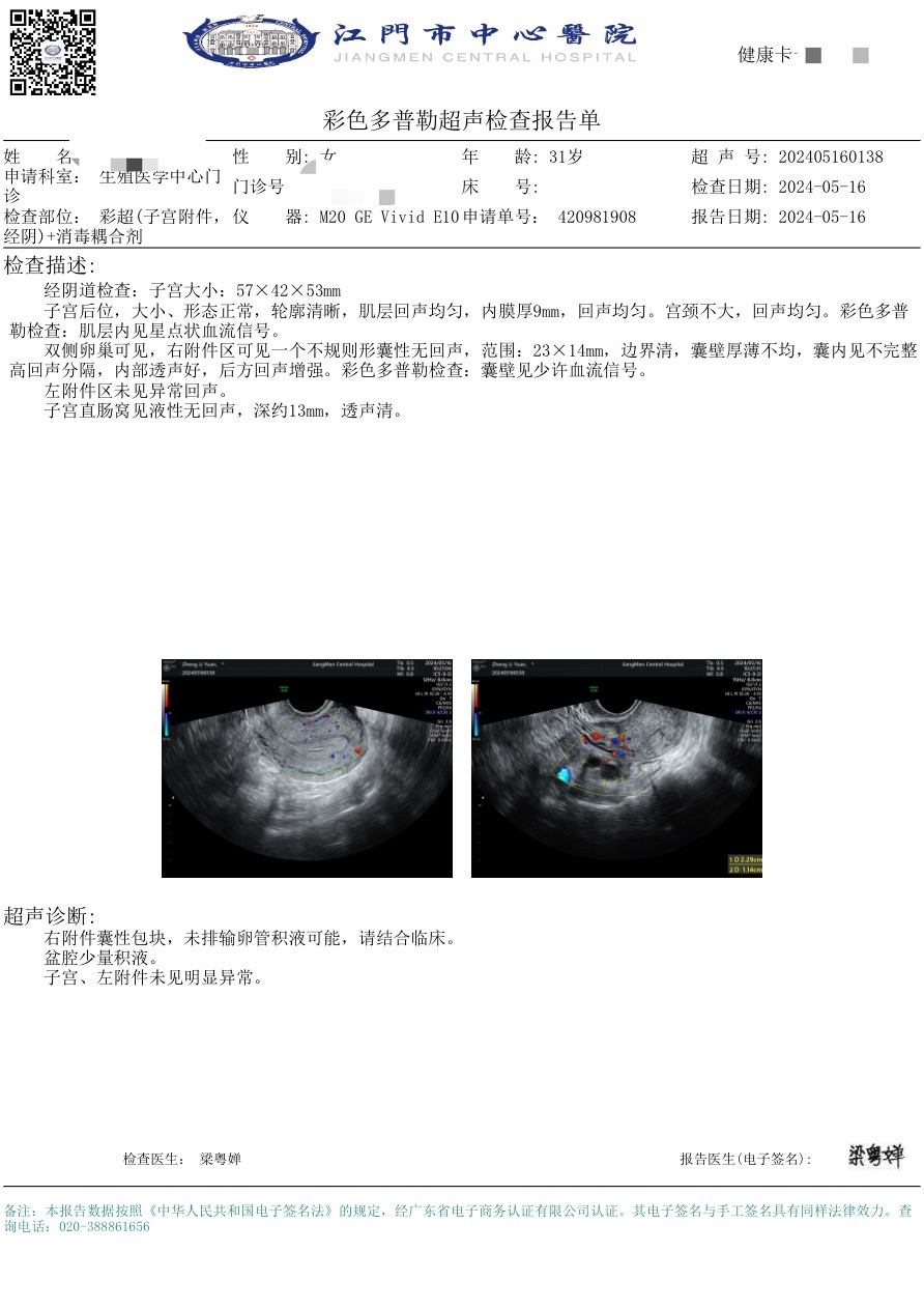 医生您好帮忙看下报告检查日为排卵期输卵管预估