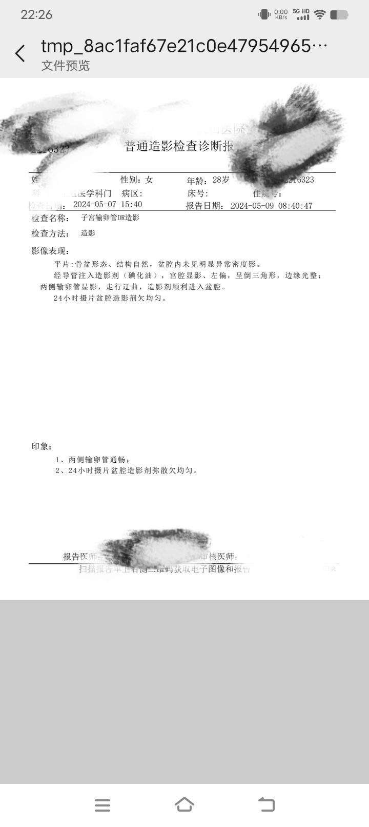 这个是输卵管造影不通吗需要做疏通手术治疗吗